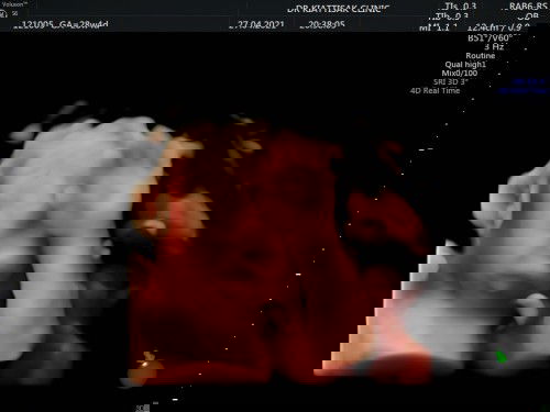 ไตรมาสที่ 3 ของแม่ๆเป็นไงบ้างฮะ