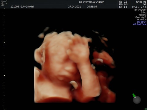 ไตรมาสที่ 3 ของแม่ๆเป็นไงบ้างฮะ