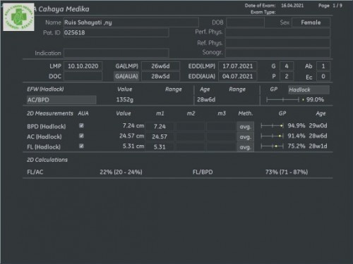 Usia kandungan ku 28 Minggu tp kok pergerakan ny kurang aktif ya Bun knp ya..