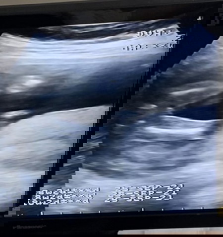 ผู้หญิง หรือ ผู้ชาย