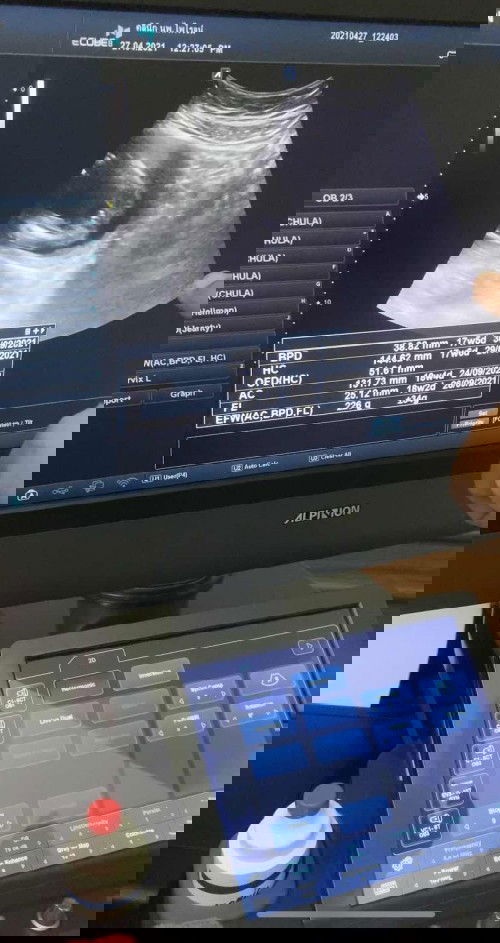 แม่ๆ ว่าเพศอะไรคะ