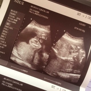 BOY OR GIRL?