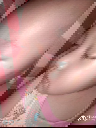 ตาเป็นตุ่ม