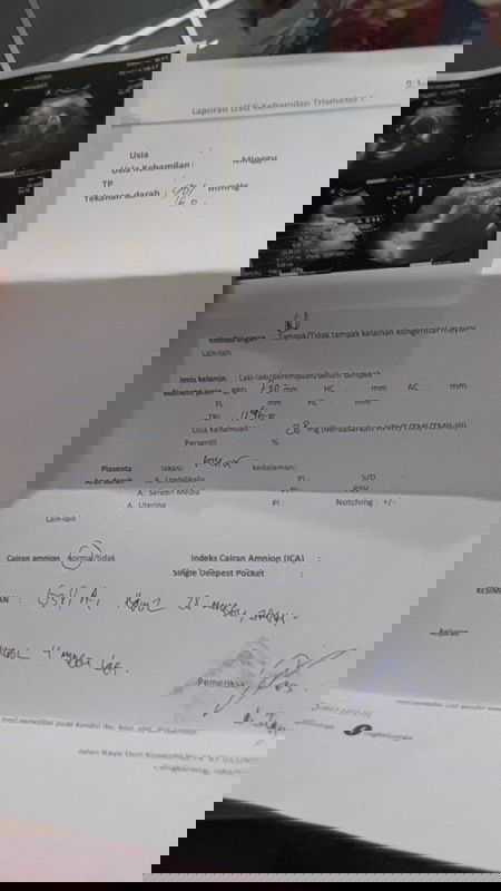 Susah melihat jenis kelamin