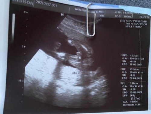 แม่ๆช่วยดูหน่อยค่ะ