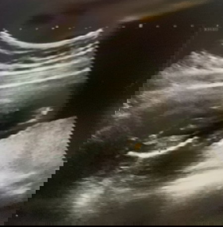 ภาพนี้คือส่วนไหนคะ...