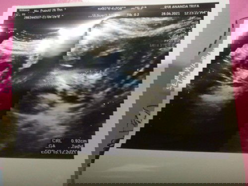 Hasil USG beda 4 minggu