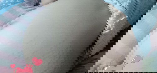 ท้องแตกลายยย..