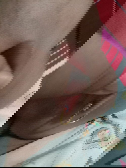 Benjolan setelah tindik telinga