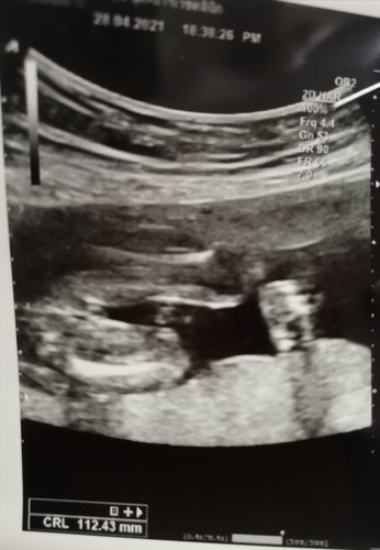 แม่ๆคะสอบถามหน่อยคะ