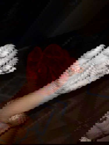 Pagpa check up ko skin ashma daw Ito . Naawa na ako as baby ko, bigla nlng umiiyak sa sakit at Kati