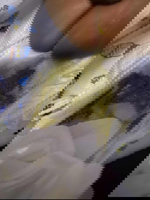 Berak bayi hijau susu fm + susu bf