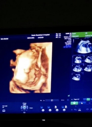 26วีค ซาวน์4มิติ