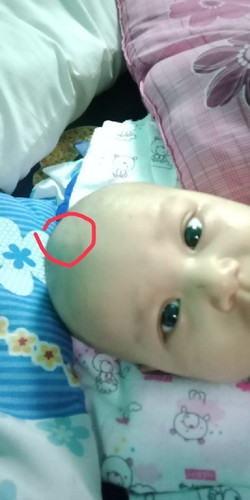 ลูกไปฉีดวัคซีน4เดือนมีไข้38.3