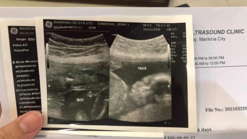 Hello mga sis baka may ma suggest kayong second name ni baby
Claude yung first name
