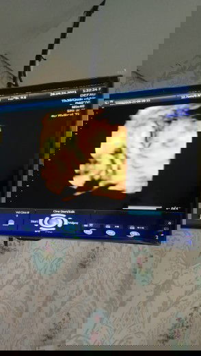 Alhamdulillah air ketuban nambah