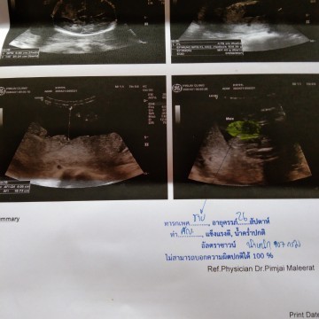 26+2น้ำหนักปกติไหมค่ะ