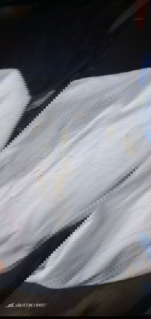 Keputihan pada anak.