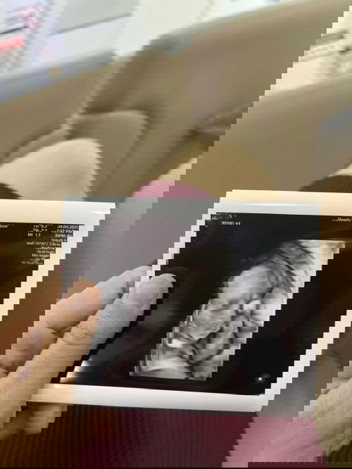 สอบถามแม่ๆ หน่อยค่ะ