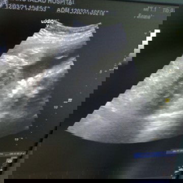 แบบนี้ชายรึหญิงคะแม่ๆ