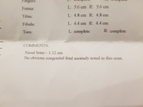 CAS result. Nasal bone