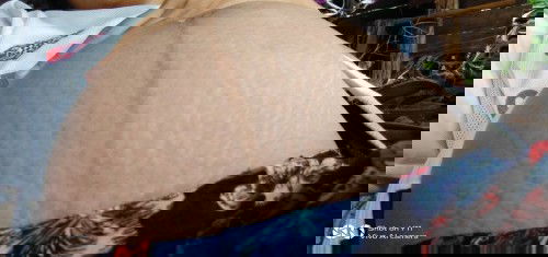 แม่ท้องคนไหนท้องลายเหมือนเราบ้างคะ อาการท้องลายเป็นช่วงไตรมาส3คะ แล้วก็อาการคันท้องมากเลยคะ