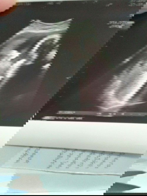 ใกล้เจอกันแล้วนะตัวน้อยยยยย