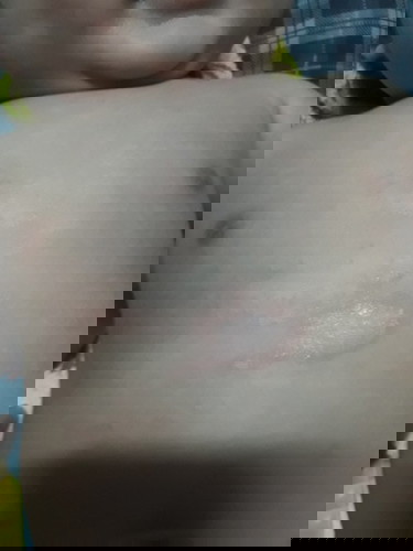 Krim apa yg sesuai untuk masalah kulit baby seperti dalam gambar..