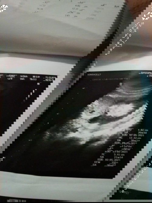 น้องเป็น ผช. รึ ผญ.คะแม่ๆ