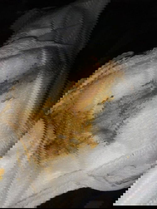 อึแบบรี้ปกติมั้ย