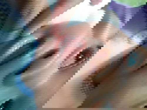 bintik putih dibibir