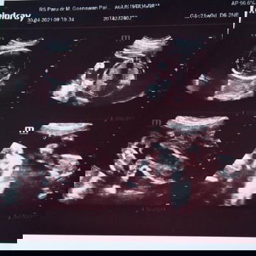 kejadian membingungkan