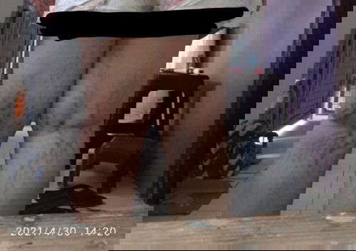 Varicose veins? Stretchmarks?