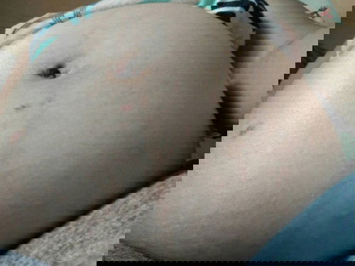 ท้อง37 wท้องเเข็งปวดหน่วงเป็นๆๆหายๆๆมีใครเป็นอย่างบ้านนี้บ้าง