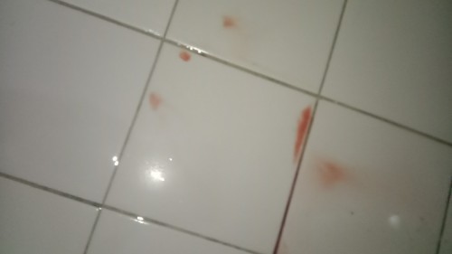 Ask lng po 13weeks po Aq buntis pang 3rd baby ko Nilabasan kc aq dugo kanina lang normal lng po kaya
