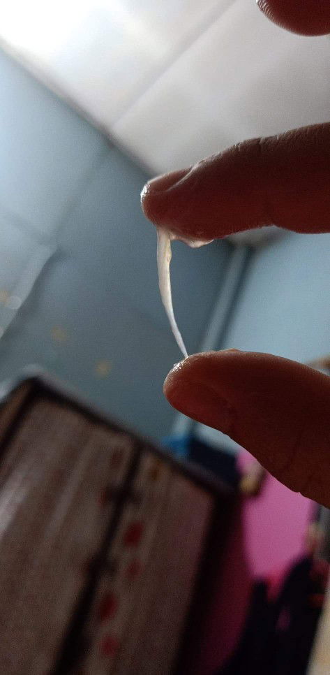 ตั้งครรภ์ 36 สัปดาห์