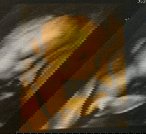 7 เดือนเเล้วครับ