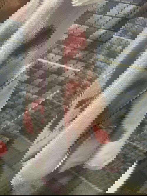 ตั้งครรรภ์ได้ 10 week 6 day