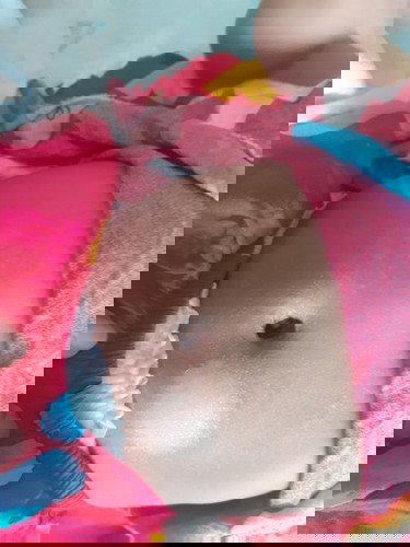 ขอคำแนะนำผื่นแพ้ที่ท้อง