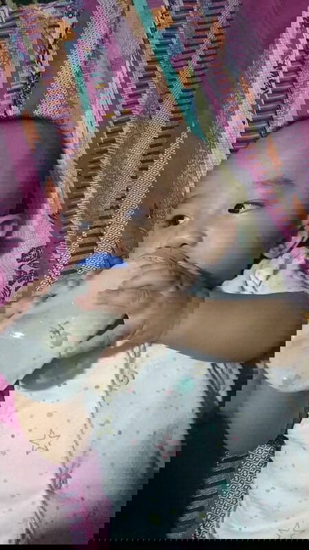 Lemak di kelopak mata kiri