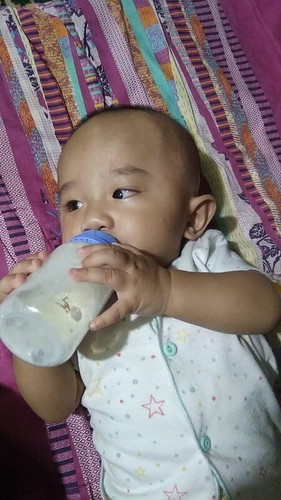 Lemak di kelopak mata kiri