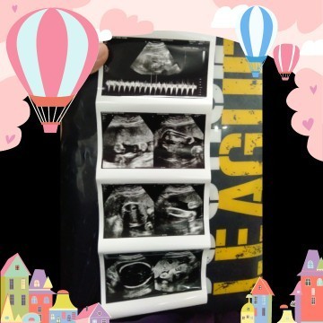 บ้านนี้ได้ลูกสาว