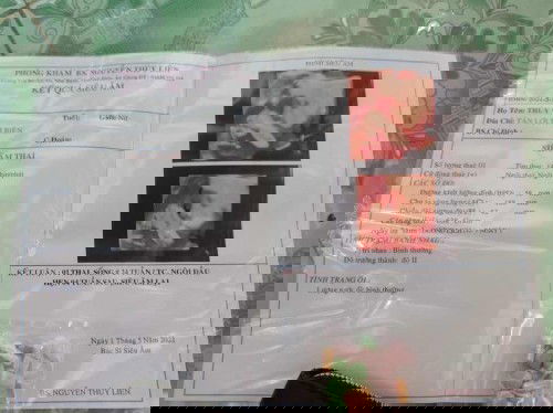 Lẩn đầu lam mẹ