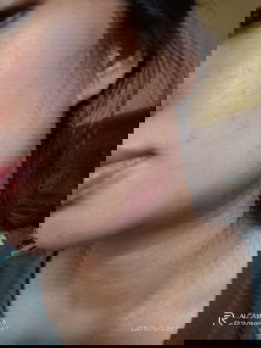 gondongan di usia kehamilan 14w 2d