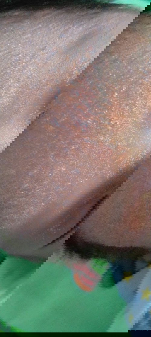 Bintik bintik itu kenapa ya