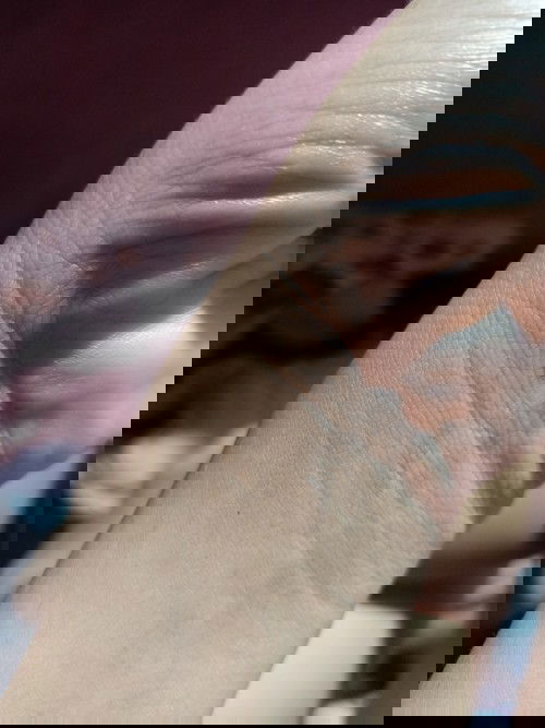 Masakit ang ugat ng kamay