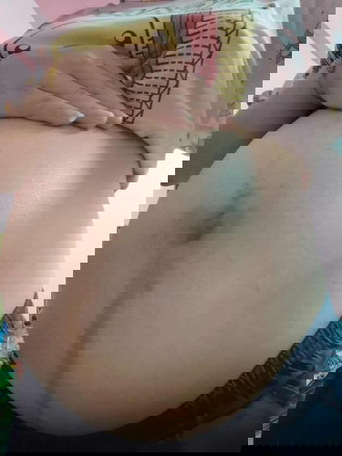 ท้องไม่แตกลาย