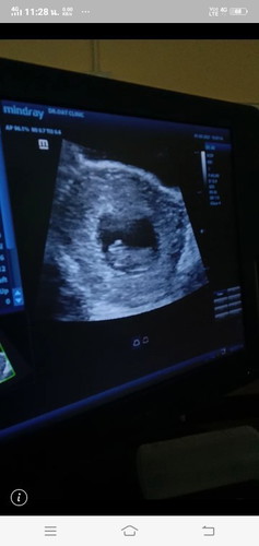 ซาวรอบสองจ้า