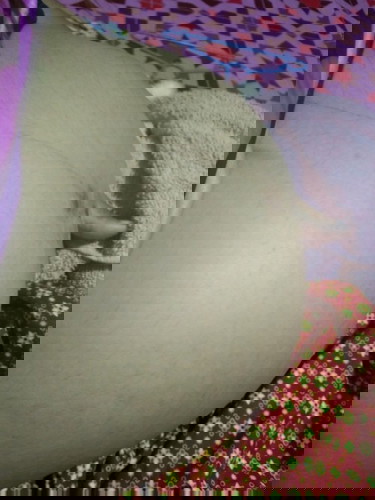 เจ็บจิมิเวลาฉี่ปกติไหม