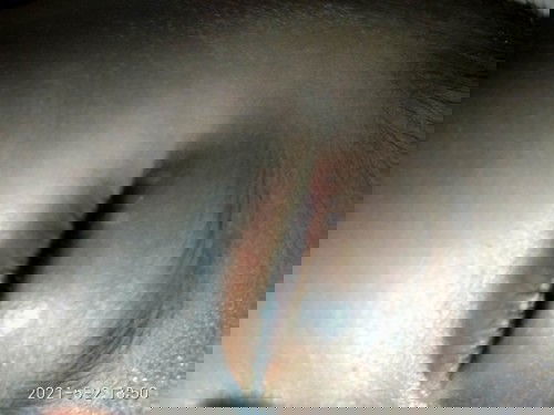 Bintik putih di mata